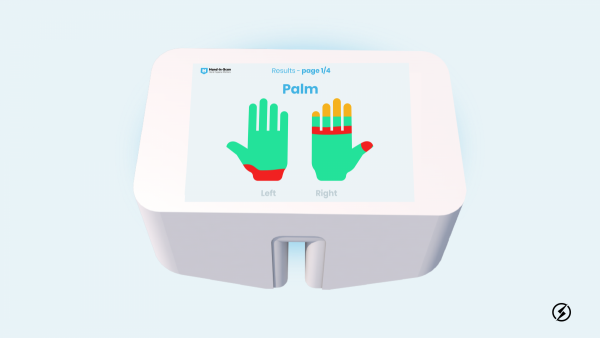 HAND IN SCAN